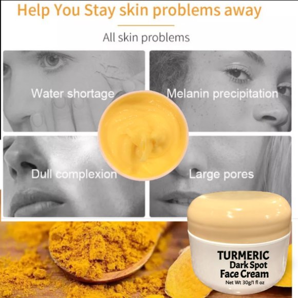Turmeric Dark Spot Cream Lemon Skin Glow Brightening Fade Cream Acne Spot… - Picture 2 of 2